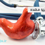 فواید اسلیو معده