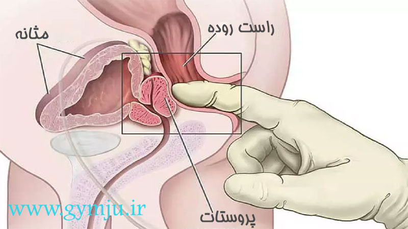 غده پروستات