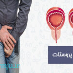 هزینه عمل پروستات