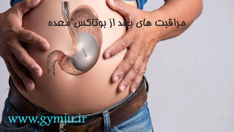 مراقبت های بعد از بوتاکس معده