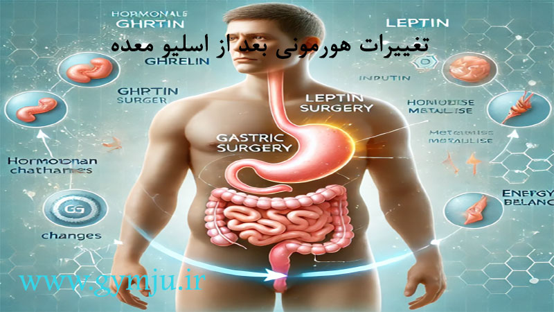 تغییرات هورمونی بعد از اسلیو معده